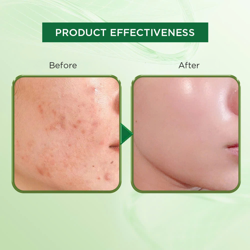 Alternative view of Cicamax Refine Serum - Centella Serum | Helps Soothe Skin and Prevent Aging - Gift