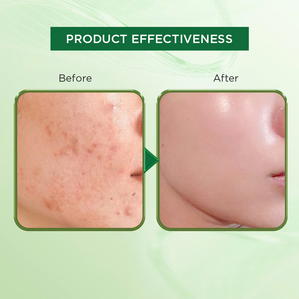 Cicamax Refine Serum - Centella Serum | Helps Soothe Skin and Prevent Aging - Gift - Image 2