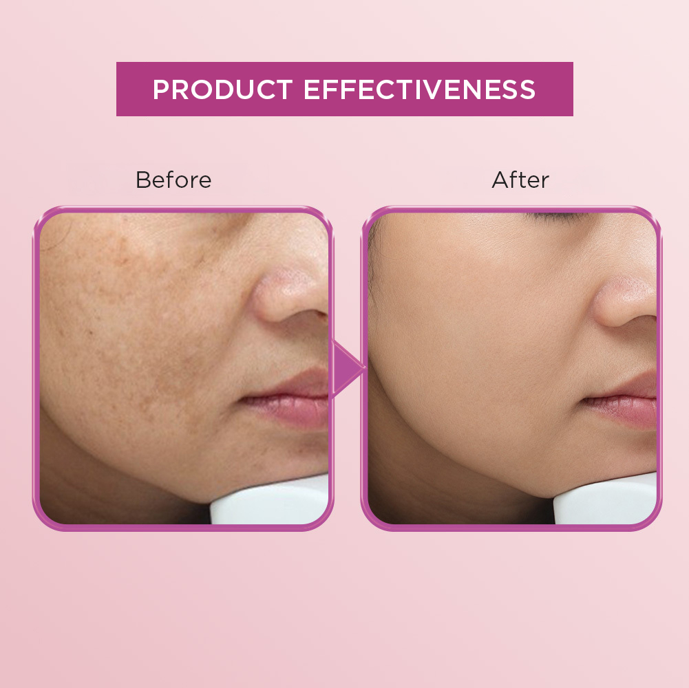Spot White Essence - Intensive Brightening Serum | Helps Brighten and Prevent Skin Aging - Image 5
